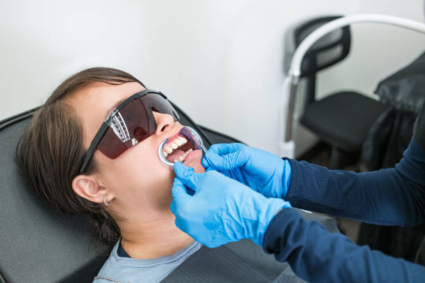 Best Knocked-Out Tooth (Avulsed Tooth) Treatment in Morrice, MI
